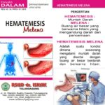 Jurnal Keperawatan Hematemesis Melena 2024