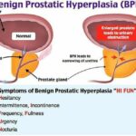 Jurnal Keperawatan Bph 2024